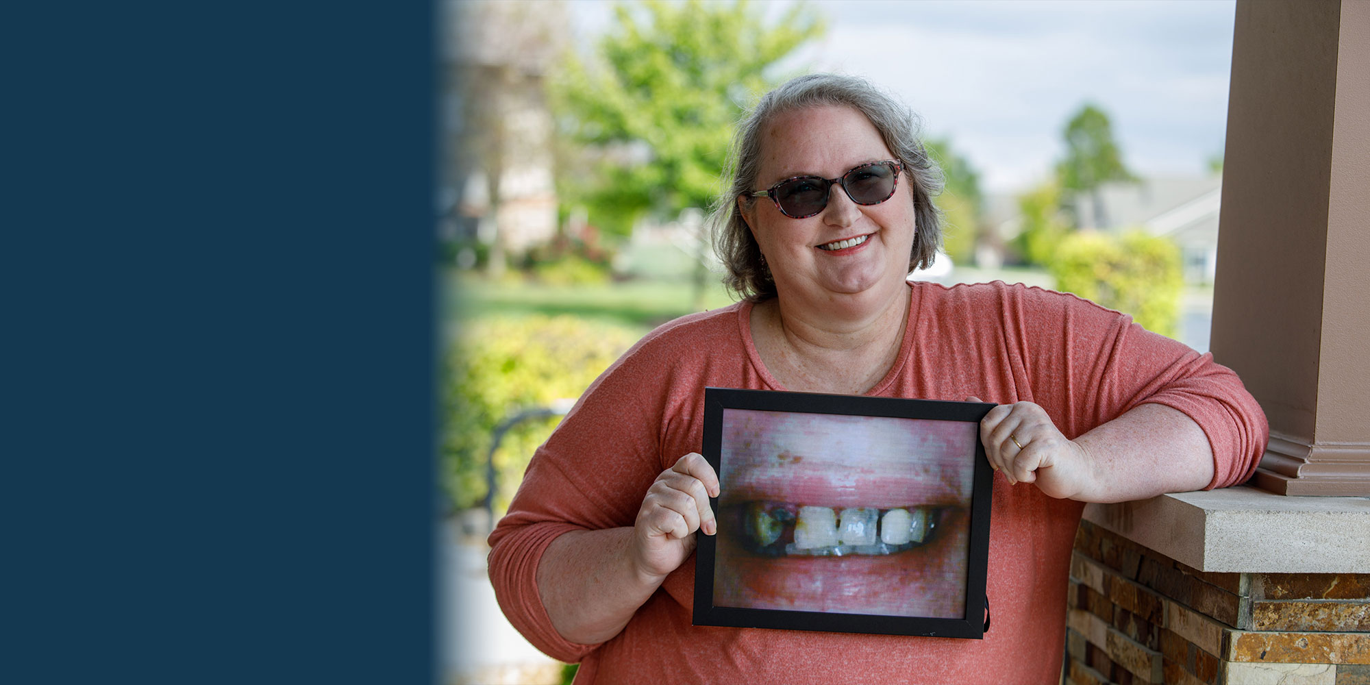 patient holding up a before photo of their teeth