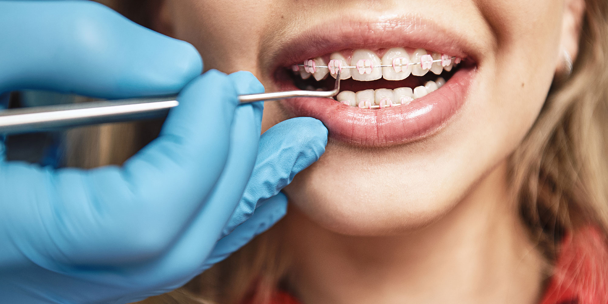 patient with braces