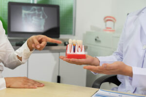 Dentist explains dental implants using model in dental clinic.